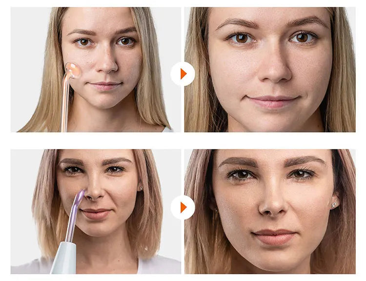 Högfrekvent rynkorborttagare