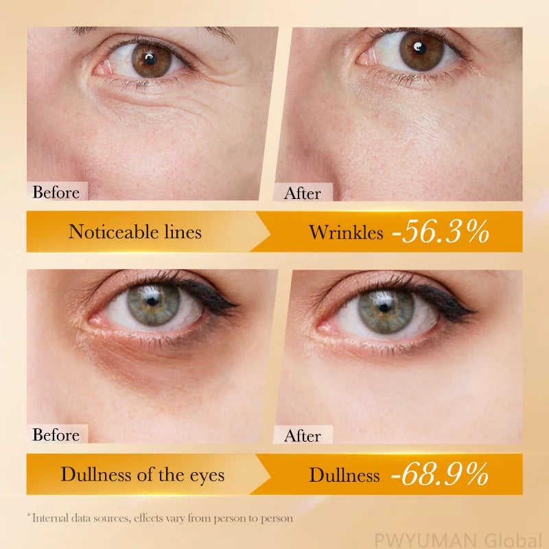 Retinol Eye Serum